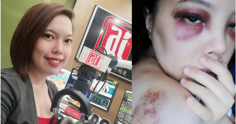 未系后座安全带 爱FM主播车祸抛撞前座挡风镜